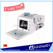 cheapest portable ultrasound machine & b w ultrasound scanner for obstetrics,gynecology